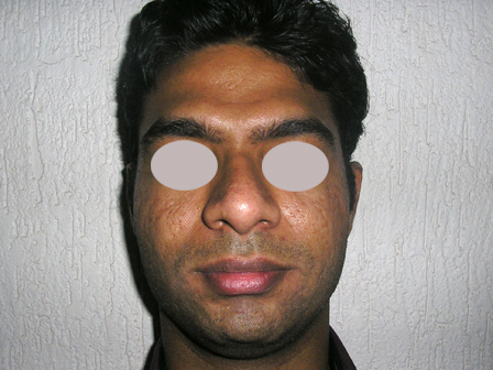 Dr Pandya Clinic Udaipur